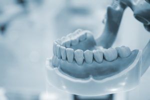 人間の顎と歯の模型