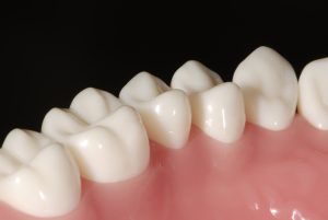 奥歯の模型